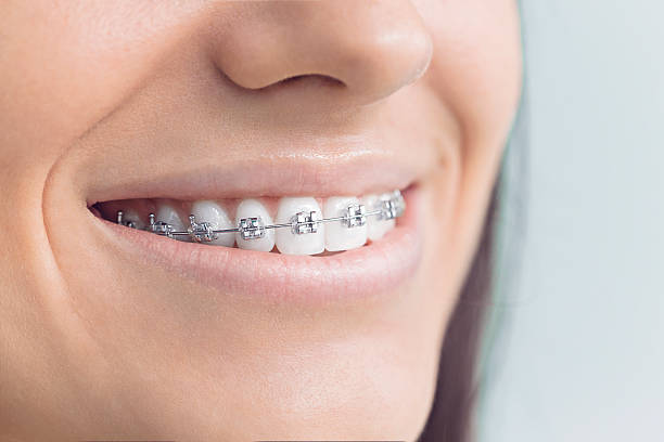 Why Choose Us for Your Dental Needs in Hollywood, FL